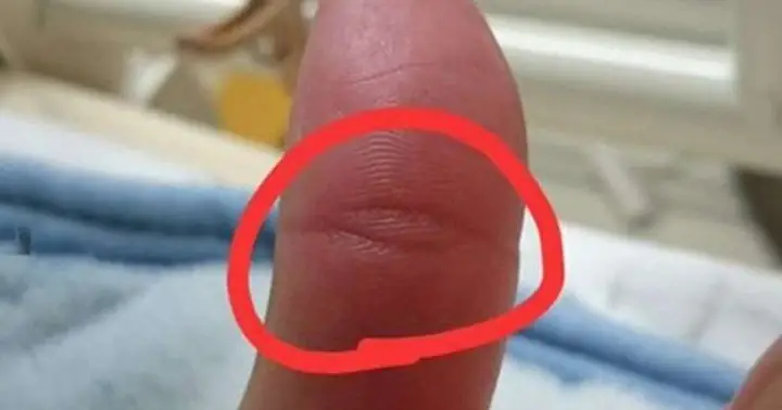 Người Sở Hữu Vân Mắt Phật Trên Ngón Tay Cái Có Vận Mệnh Như Thế ...