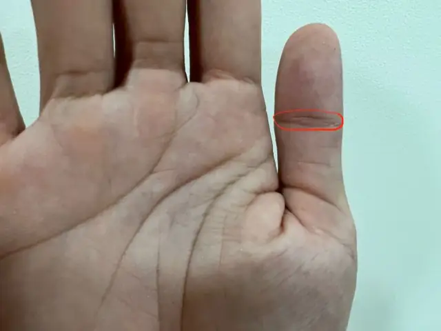 Vân Tay Mắt Phượng Là Gì? Có Đúng Sẽ Đem Lại Vận Mệnh Tốt?