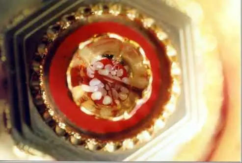 Nguyên Nhân Hình Thành Các Hạt Xá Lợi Phật