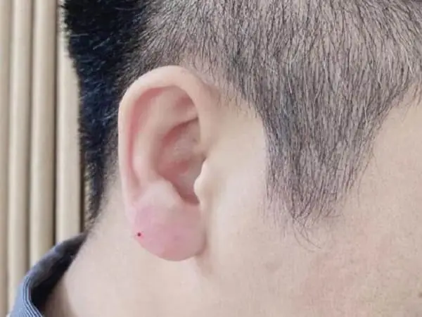 Ý Nghĩa Nhân Tướng Của Người Có Tướng Tai Phật