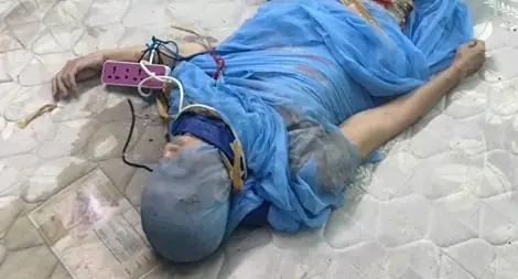 Tin Theo Tà Đạo, Đóng Đinh Vào Đầu... Trị Bệnh “ma Nhập”(!)