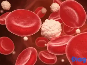 Biến Chứng Cấp Tính