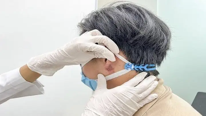 Hiểm Họa Từ Trào Lưu Nam Giới Tạo Tai Phật Bằng Tiêm Filler - Ảnh 1.