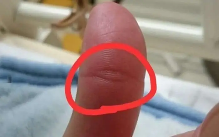 Vân Mắt Phật Là Gì?