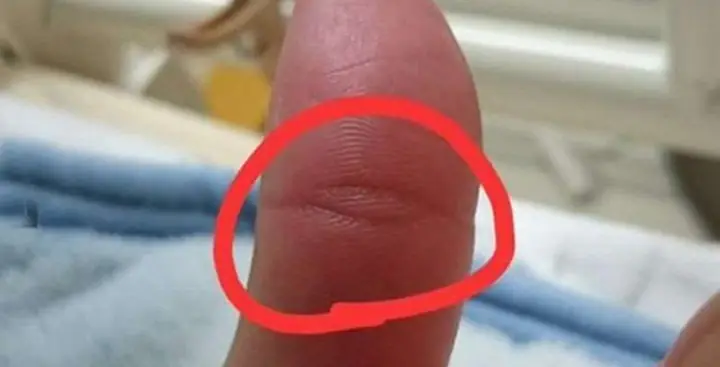 Vân Mắt Phật Là Gì?