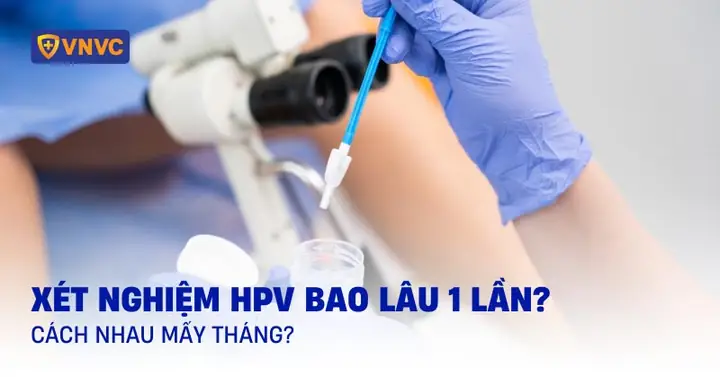 Nên Xét Nghiệm Hpv Bao Lâu 1 Lần? Cách Nhau Mấy Năm?