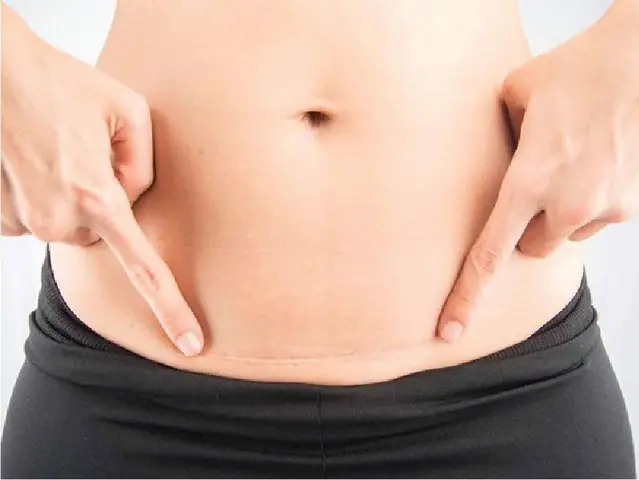 Cách Xử Trí Dọa Sảy Thai 3 Tháng Đầu | Vinmec