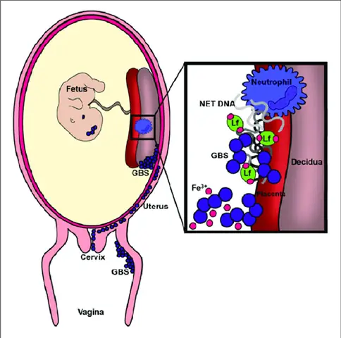 Nhiễm Liên Cầu Khuẩn Nhóm B (gbs) Ở Phụ Nữ Mang Thai - Bệnh ...