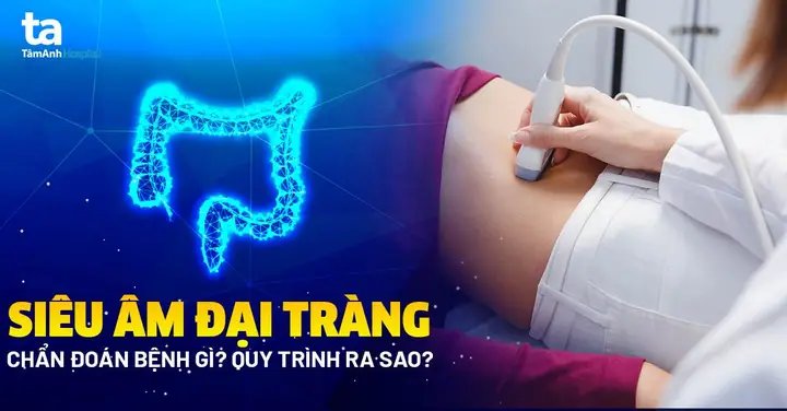 Siêu Âm Đại Tràng: Chẩn Đoán Bệnh Gì? Quy Trình Và Ưu Nhược Điểm