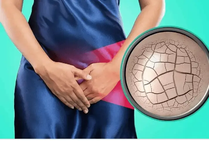 Khô Âm Đạo Ở Phụ Nữ Tiền Mãn Kinh Và Mãn Kinh: Cách Xử Lý | Vinmec