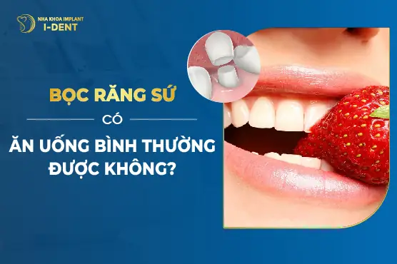 Bọc Răng Sứ Bao Lâu Thì Ăn Được Bình Thường?