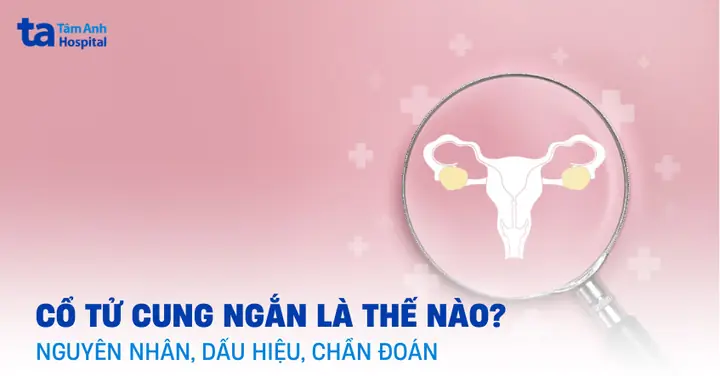 Cổ Tử Cung Ngắn: Nguyên Nhân, Dấu Hiệu, Chẩn Đoán, Phòng Ngừa