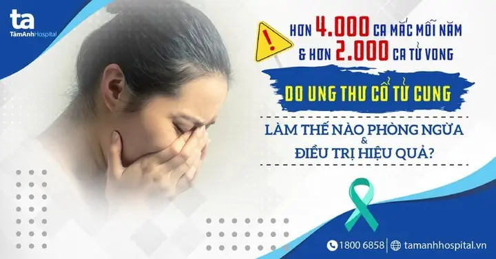 Đề Tính Cưng Chẩn Tế Vector: Tổng Quan Và Cách Thực Hiện