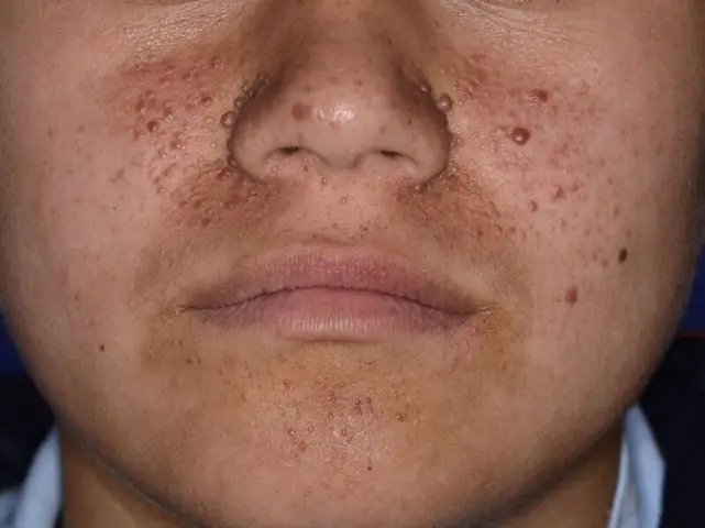 Đề Tính Cưng Chuẩn Tế Vector: Câu Chuyện Về Giá Trị Và Cách Thức Triển Khai