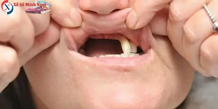 Giải Mã Giấc Mơ Rụng Răng: Những Điềm Báo Tâm Linh Và Thông Điệp Từ Tiềm Thức