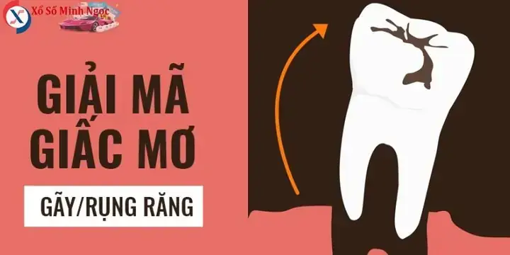 Giải Mã Giấc Mơ Rụng Răng: Những Điềm Báo Tâm Linh Và Thông Điệp Từ Tiềm Thức