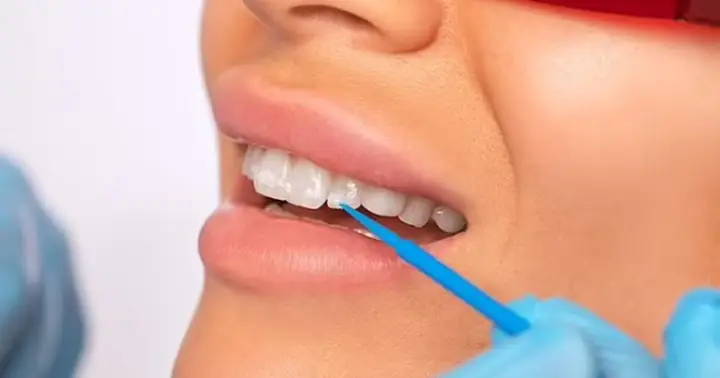 Giải Mã Giấc Mơ Gãy Răng: Điềm Báo Gì Và Những Con Số May Mắn Ẩn Chứa