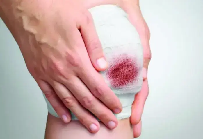 Giải Mã Giấc Mơ Bị Dao Đâm Chảy Máu: Biểu Tượng Tâm Lý & Điềm Báo Tâm Linh