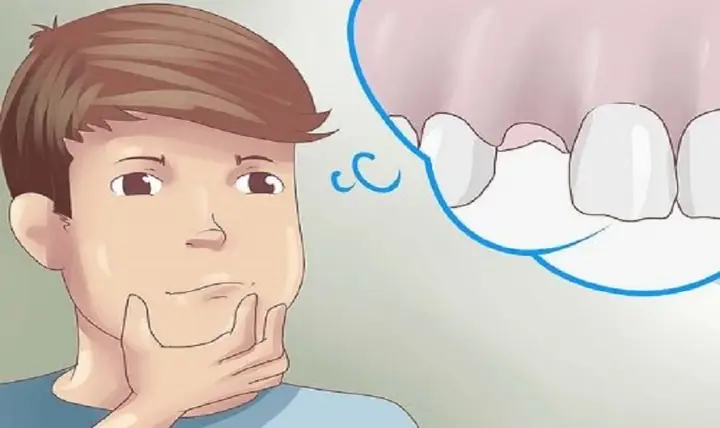 Giải Mã Giấc Mơ Gãy Răng: Điềm Lành Hay Dữ? Ý Nghĩa Thực Sự Đằng Sau