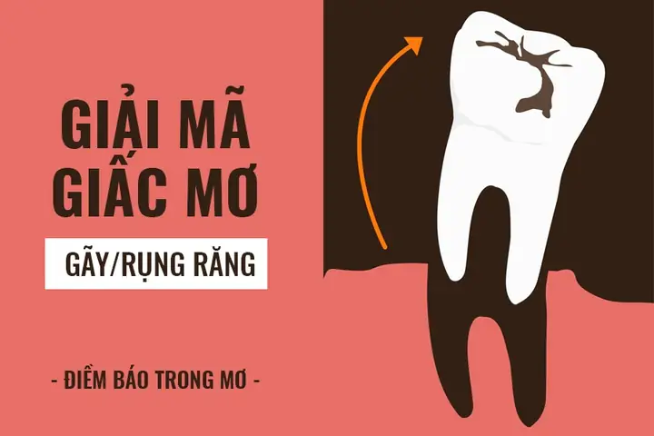 Giải Mã Giấc Mơ Bị Rụng Răng: Điềm Báo Gì Và Nên Làm Gì?