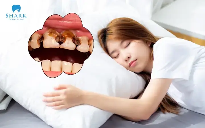 Giải Mã Giấc Mơ Bị Sâu Răng: Điềm Báo Hay Lời Nhắc Nhở Sức Khỏe?