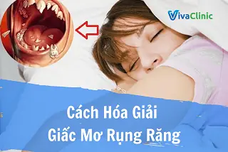 Giải Mã Giấc Mơ: Bị Gãy Răng Có Ý Nghĩa Gì Và Điềm Báo Gì?