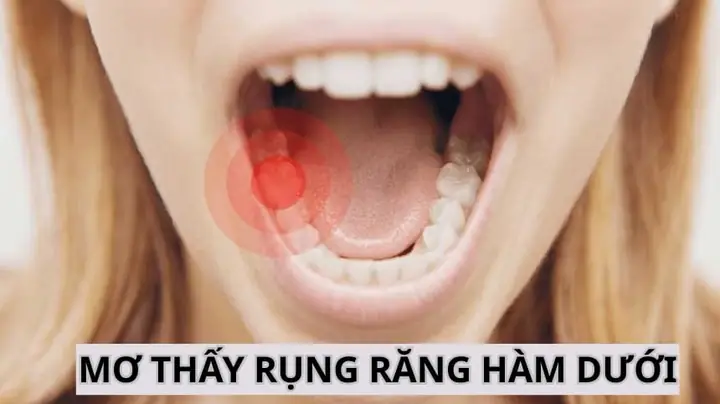 Giải Mã Giấc Mơ Rụng Răng Hàm Dưới: Thông Điệp Gì Từ Tiềm Thức?