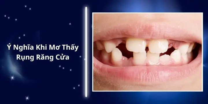 Giải Mã Giấc Mơ Rụng Răng Cửa: Ý Nghĩa Tâm Linh, Điềm Báo Và Con Số May Mắn