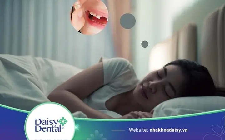 Giải Mã Giấc Mơ Rụng Răng Hàm Trên: Điềm Báo Tâm Linh Hay Lời Cảnh Báo Sức Khỏe?