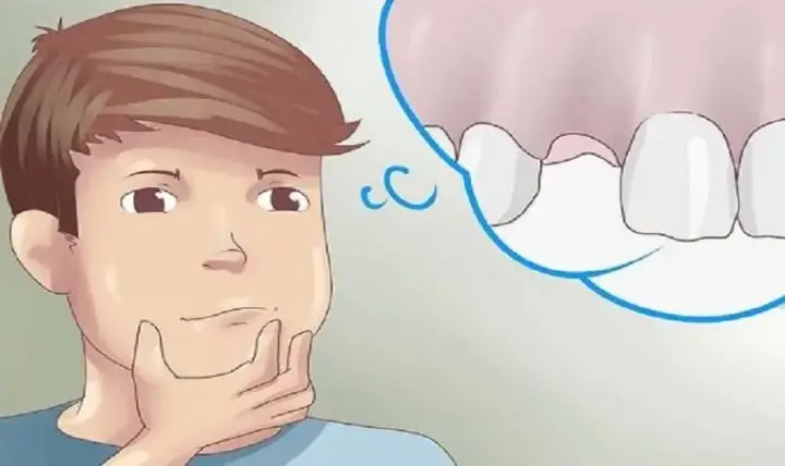 Giải Mã Giấc Mơ Rụng Răng Không Chảy Máu: Góc Nhìn Tâm Lý, Văn Hóa Và Thực Tiễn