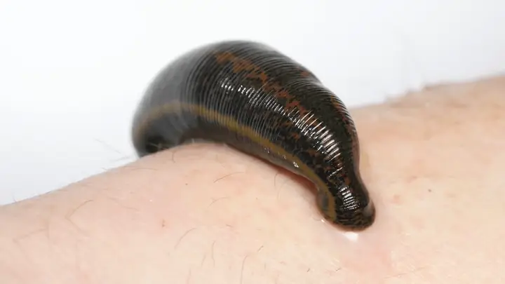 Giải Mã Giấc Mơ Thấy Đỉa Bám Vào Chân: Chi Tiết Các Điềm Báo Và Ý Nghĩa