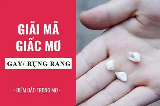 Giải Mã Giấc Mơ Thấy Gãy Răng: Điềm Báo Gì Và Những Con Số May Mắn