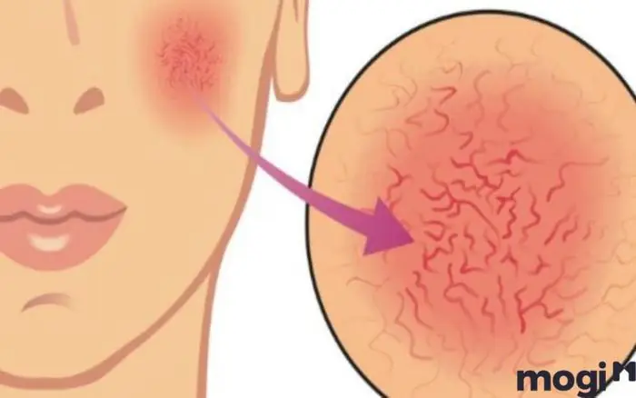 Giải Mã Giấc Mơ Thấy Máu: Ý Nghĩa Và Điềm Báo Chi Tiết Cho Từng Trường Hợp