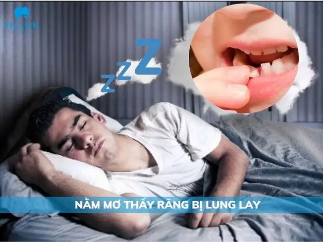 Giải Mã Giấc Mơ Thấy Răng Nổi Mũ: Gợi Ý Từ Tiềm Thức Về Sự Thay Đổi Và Bảo Vệ