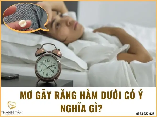 Giải Mã Giấc Mơ Thấy Vô Phòng Răng: Ý Nghĩa Đằng Sau Từng Chi Tiết