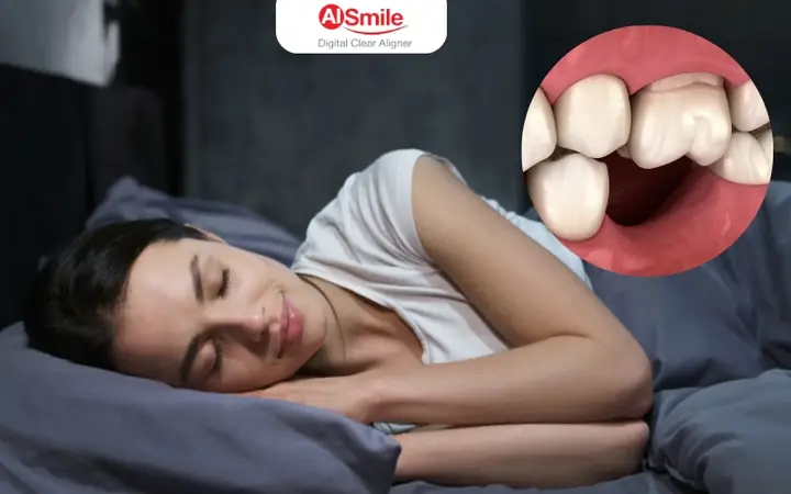 Giải Mã Giấc Mơ Về Con Nhái: Những Điềm Báo Và Ý Nghĩa Tâm Linh Bạn Cần Biết