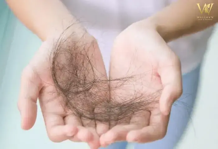 Giải Mã Giấc Mơ Xem Chỉ Tay: Thông Điệp Ẩn Giấu Từ Tiềm Thức