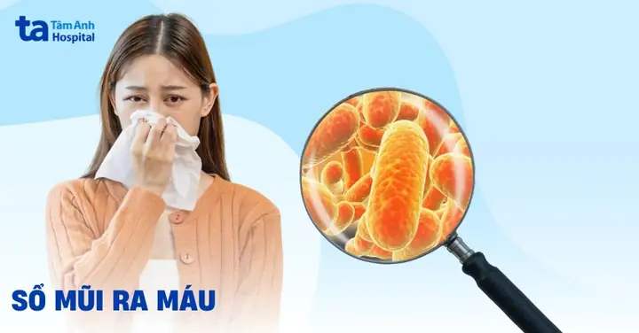 Sổ Mũi Ra Máu (dịch Mũi Lẫn Máu): Nguyên Nhân Và Phòng Ngừa