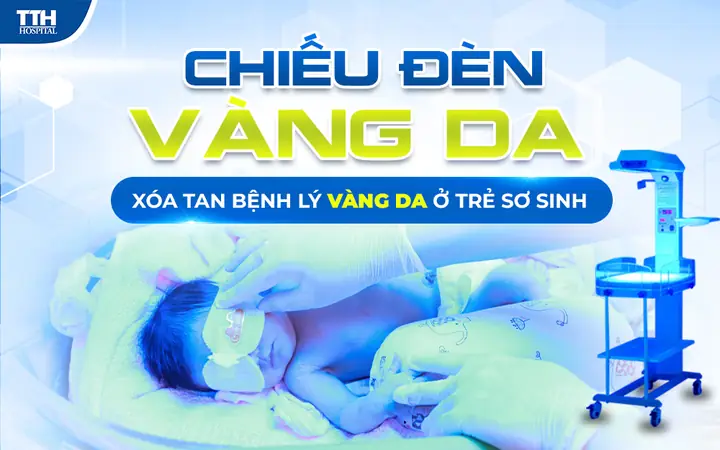 Chiếu Đèn Vàng Da - Xóa Tan Bệnh Lý Vàng Da Ở Trẻ Sơ ...