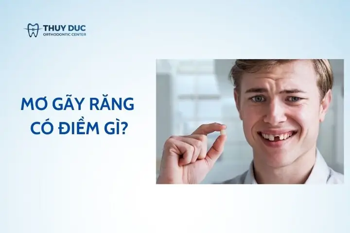 Giải Mã Giấc Mơ Bị Gãy Răng: Điềm Báo Tâm Linh, Tâm Lý Và Lời Khuyên Thực Tế