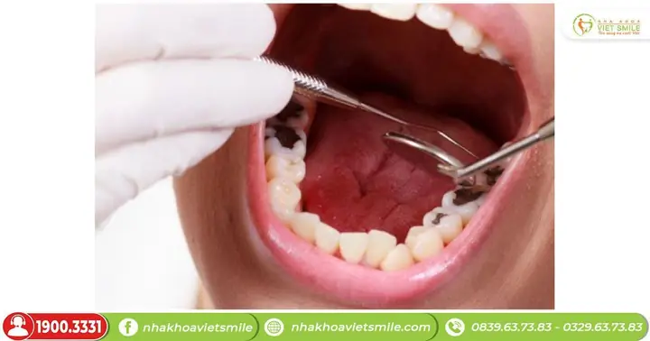 Giải Mã Giấc Mơ Rụng Răng: 7 Ý Nghĩa Tâm Linh Và Khoa Học Bạn Cần Biết