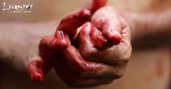 Giải Mã Giấc Mơ Thấy Băng Vệ Sinh Có Máu: Điềm Báo Gì Và Con Số May Mắn