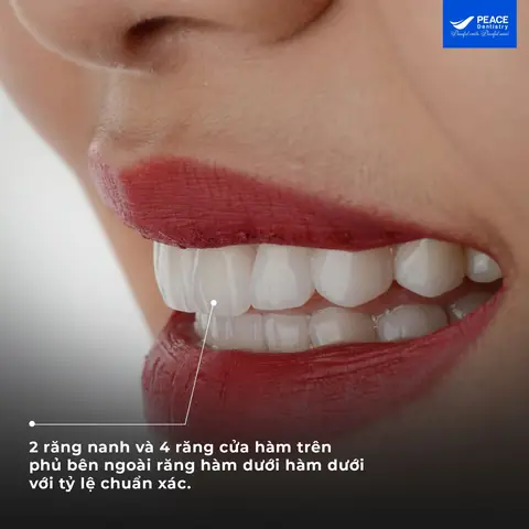 Mơ Thấy Gãy Răng Là Điềm Báo Gì? Giải Mã Chi Tiết Từ Tâm Linh Đến Khoa Học