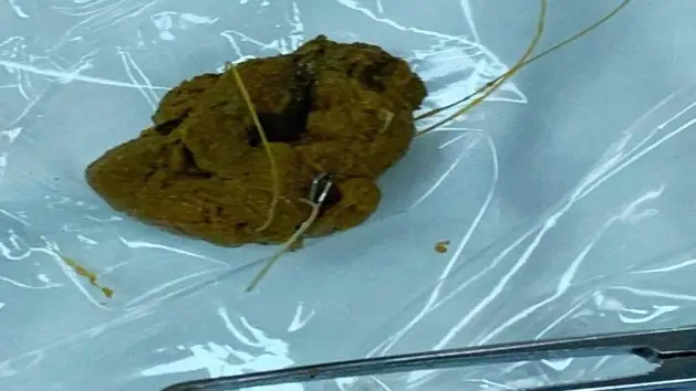 Giải Mã Giấc Mơ Thấy Lưỡi Câu Móc Vào Tay: Điềm Báo Gì Và Con Số May Mắn