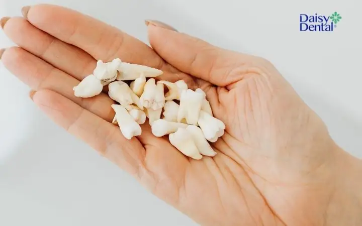 Giải Mã Giấc Mơ Thấy Rụng Răng Chảy Máu: Điềm Báo Gì Và Những Điều Cần Biết