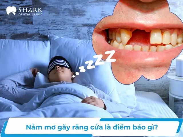 Giải Mã Ý Nghĩa Và Con Số May Mắn Khi Nằm Mơ Thấy Gãy Răng Cửa