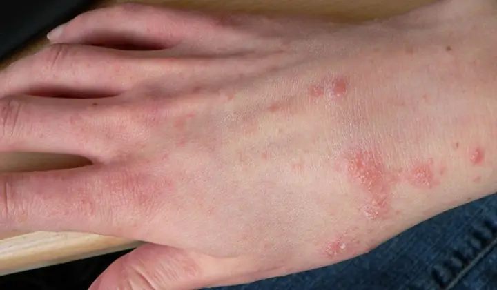 Nằm Mơ Thấy Ghẹ Đánh Đề Con Gì? Giải Mã Chi Tiết Điềm Báo & Con Số May Mắn