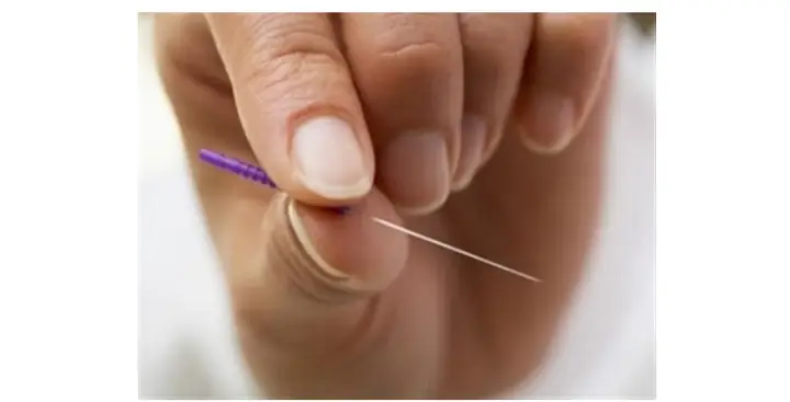 Nằm Mơ Thấy Kim Khâu Đánh Con Gì? Giải Mã Bí Ẩn Và Con Số May Mắn