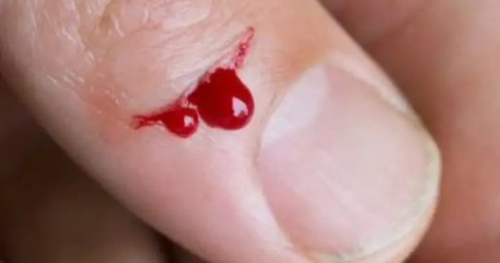 Giải Mã Giấc Mơ Chảy Máu Tay: Điềm Báo Gì Và Những Con Số May Mắn