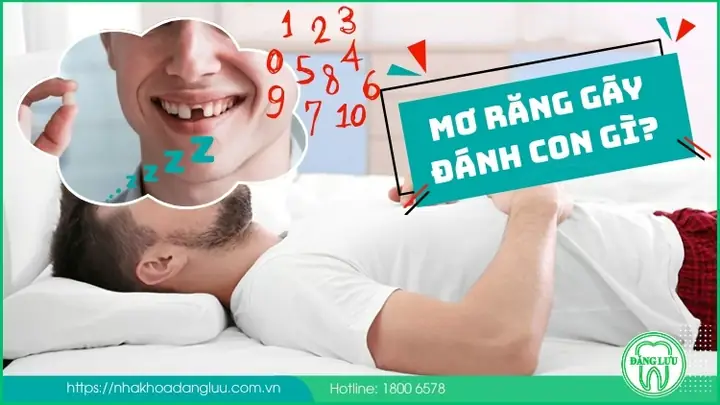 Nằm Mơ Thấy Mình Bị Gãy Chân Đánh Con Gì? Giải Mã Giấc Mơ & Con Số May Mắn